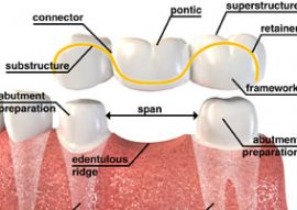 Sokchea Dental