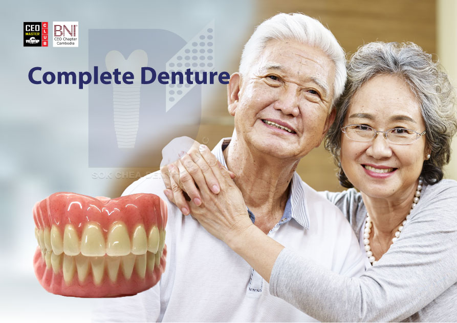 A5(Complete-Denture)