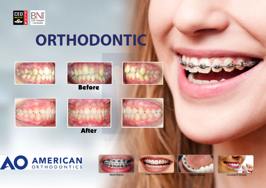 A5(Orthodontic)