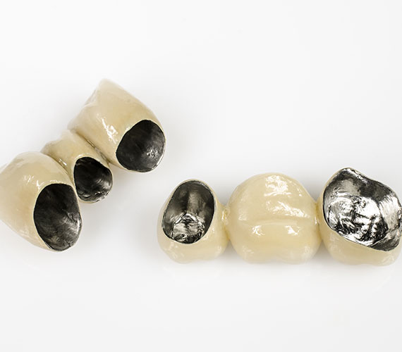 Dental-Crown