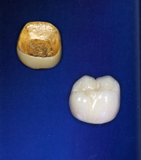 Gold Ceramic