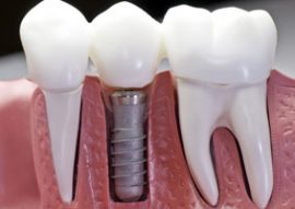 Sokchea Dental